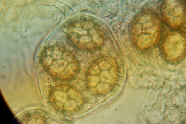Tuber aestivum